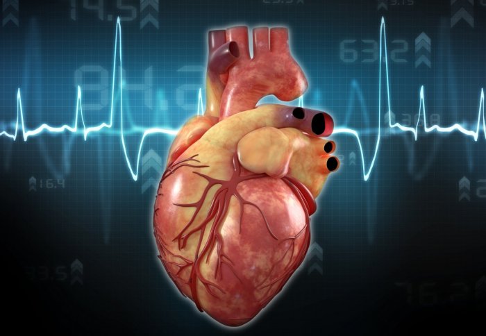 Nghiên cứu mới hứa hẹn mang lại cuộc cách mạng trong điều trị bệnh tim ...