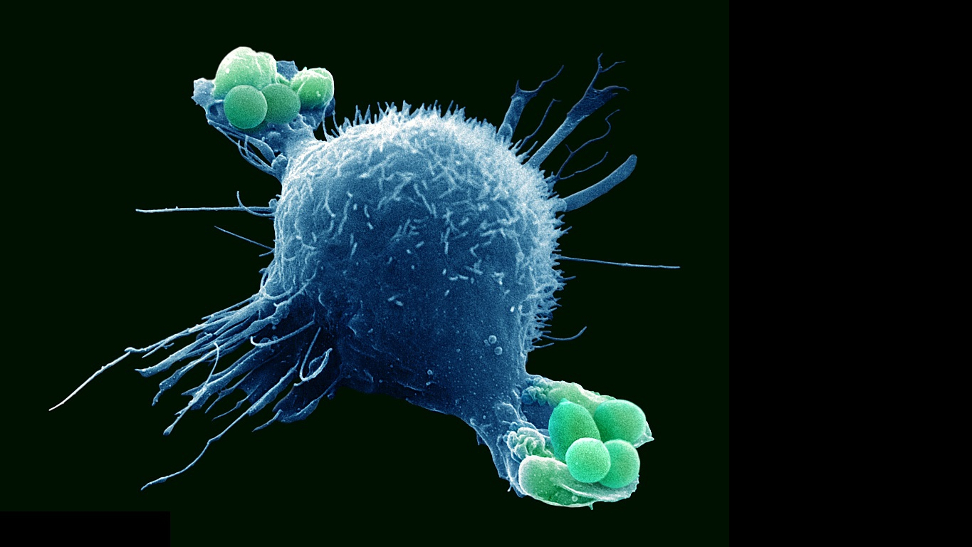 Иммунная система бактерий. Лимфоциты фагоциты вирусы. Макрофаги под микроскопом. Макрофаги под микроскопом цитология. Клетки макрофагической системы.