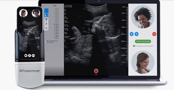 Thiết bị cầm tay giúp thai phụ tự thực hiện siêu âm tại nhà