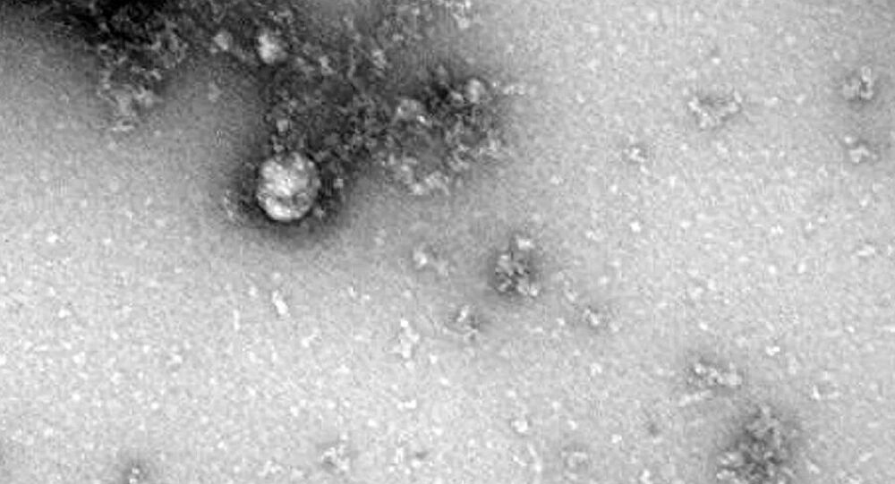 Đây là hình ảnh hiển vi đầu tiên về biến thể mới của virus SARS-CoV-2 phát. Cùng xem ngay để hiểu rõ hơn về sự phát triển của loại virus này, từ đó giúp chúng ta có phương án phòng chống tốt hơn trong tương lai.