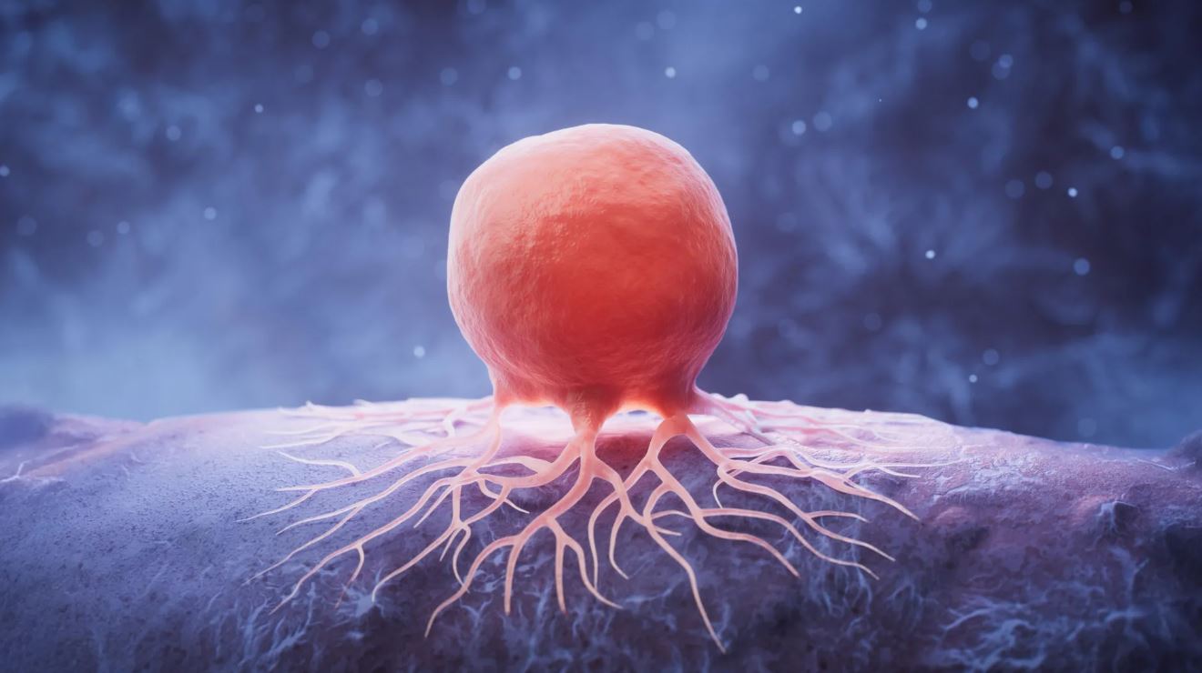 Giảm chất béo có thể 'bỏ đói' tế bào ung thư vú